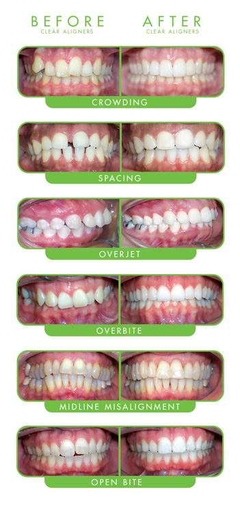 Large-Case-Types