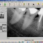 digital-dental-xrays-150×150