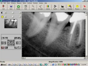 digital-dental-xrays-300×225