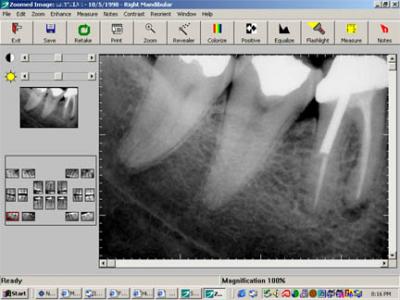 digital-dental-xrays