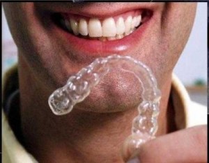 invisalign-questions-300×234