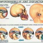 tmj-dysfunctions-150×150